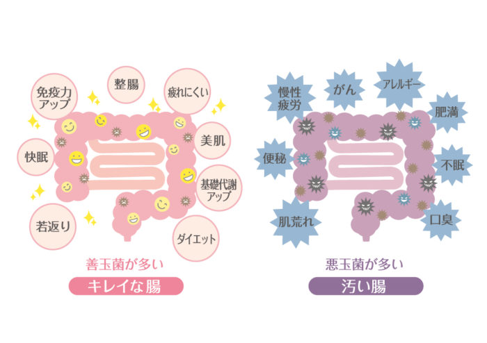 綺麗な腸と汚い腸